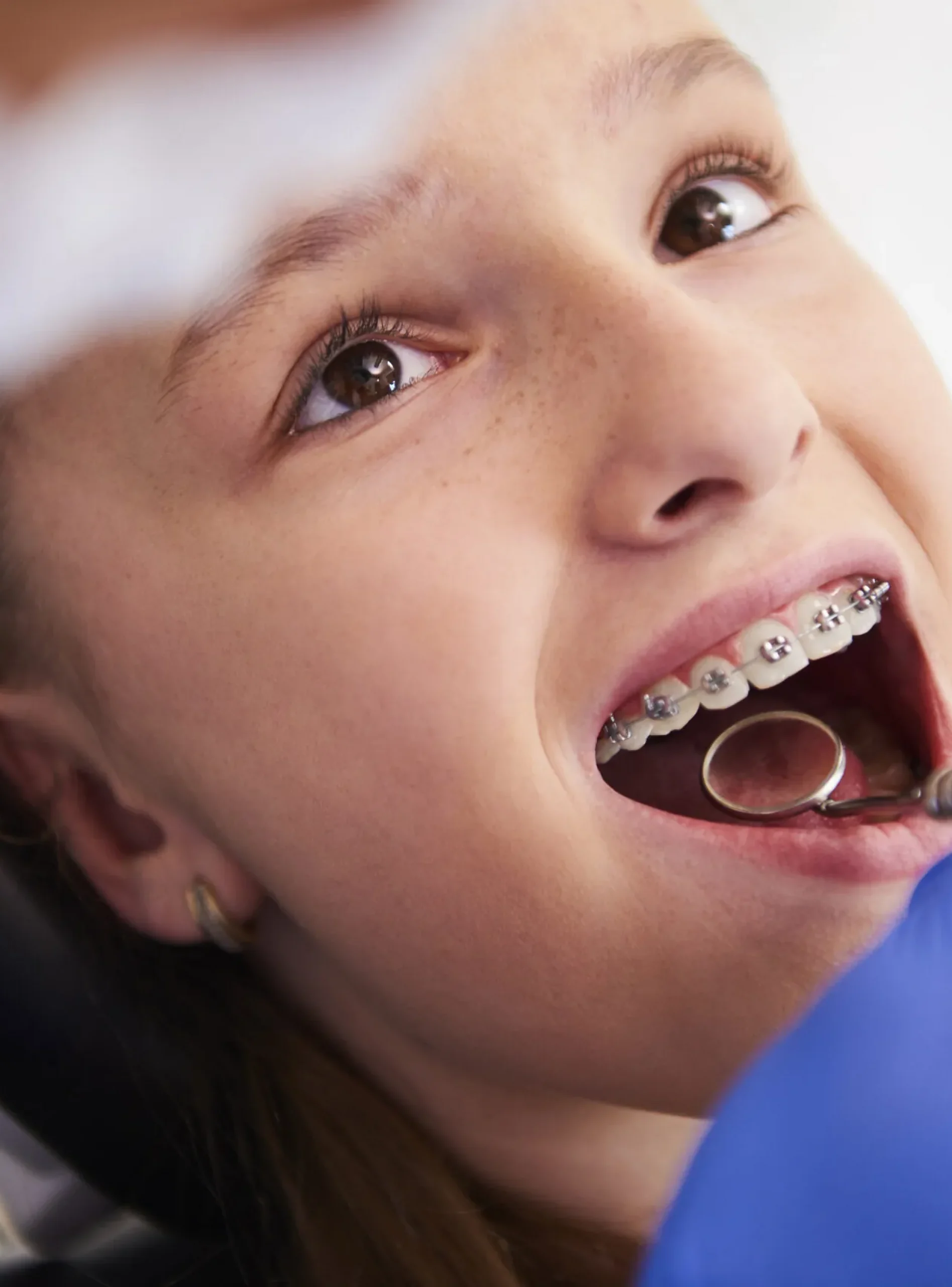 Make a Smile-Braces