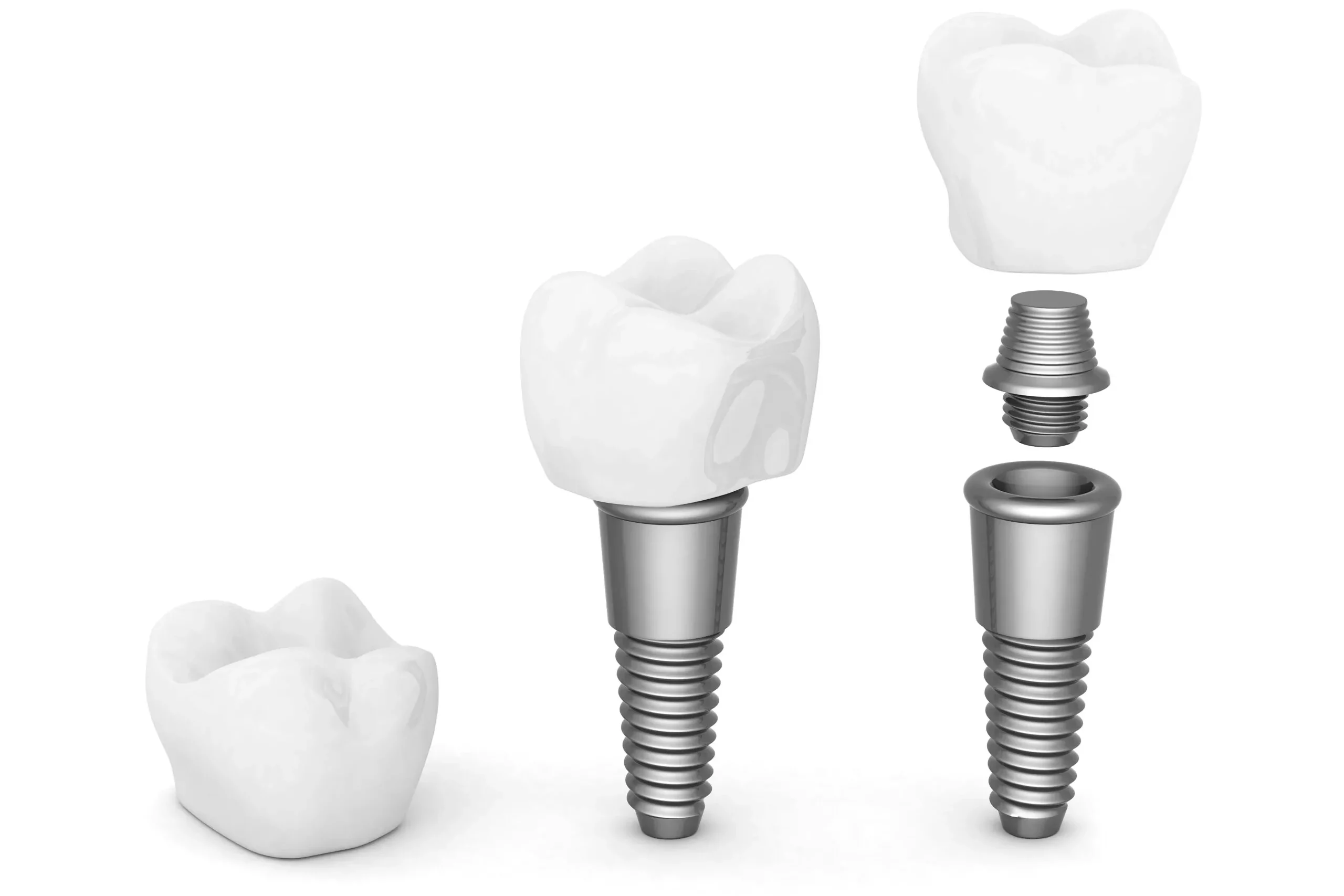 Make a Smile Dental Implants